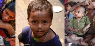 Child Malnutrition – India’s Humongous Challenge