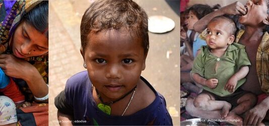 Child Malnutrition – India’s Humongous Challenge