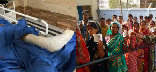 New twist in Bengal polls: Mamata sustains leg injuries, calls its conspiracy; BJP sees stunt mamta injured before bengal election